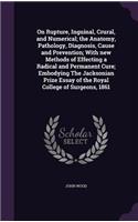 On Rupture, Inguinal, Crural, and Numerical; the Anatomy, Pathology, Diagnosis, Cause and Prevention; With new Methods of Effecting a Radical and Permanent Cure; Embodying The Jacksonian Prize Essay of the Royal College of Surgeons, 1861