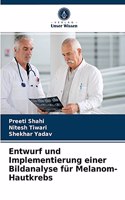 Entwurf und Implementierung einer Bildanalyse für Melanom-Hautkrebs