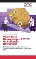 Valor de la Neuroimagen PET CT de Epilepsia Refractaria