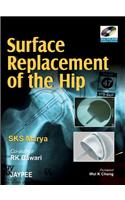 Surface Replacement of the Hip