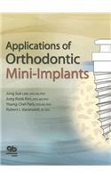 Applications of Orthodontic Mini-Implants