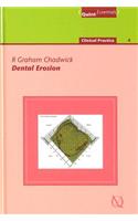 Dental Erosion