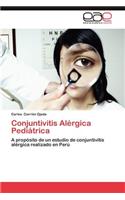 Conjuntivitis Alergica Pediatrica: (Spanish)