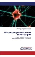 Magnitno-Rezonansnaya Tomografiya