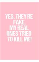 Yes, they're fake. My real ones tried to kill me!