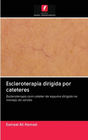 Escleroterapia dirigida por cateteres