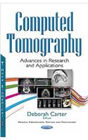 Computed Tomography