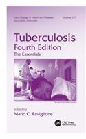 Tuberculosis