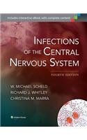 Infections of the Central Nervous System