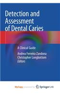 Detection and Assessment of Dental Caries