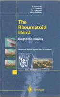 Rheumatoid Hand