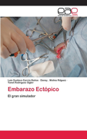 Embarazo Ectópico