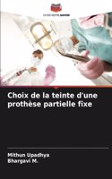 Choix de la teinte d'une prothèse partielle fixe