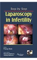 Step by Step Laparoscopy in Infertility