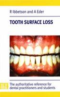 Tooth Surface Loss