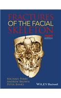 Fractures of the Facial Skeleton