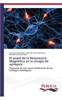 papel de la Resonancia Magnética en la cirugía de epilepsia