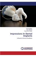 Impressions In Dental Implants