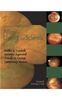 Sankara Nethralaya's Atlas of Uveitis and Scleritis