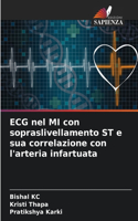 ECG nel MI con sopraslivellamento ST e sua correlazione con l'arteria infartuata