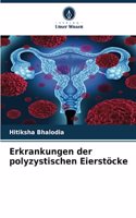 Erkrankungen der polyzystischen Eierstöcke