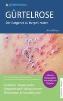 Gürtelrose - Der große Ratgeber zu Herpes zoster
