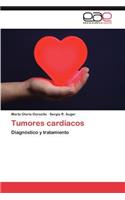 Tumores Cardiacos