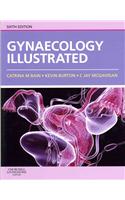 Gynaecology Illustrated