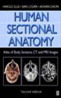 Human Sectional Anatomy, 2Ed: Atlas of Body Sections, CT and MRI Images