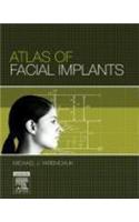 Atlas of Facial Implants