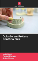 Oclusão em Prótese Dentária Fixa