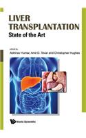 Liver Transplantation: State of the Art