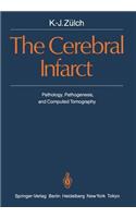 Cerebral Infarct
