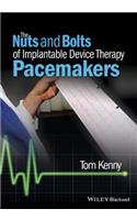 Nuts and Bolts of Implantable Device Therapy -Pacemakers