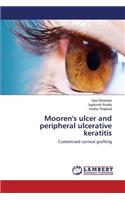 Mooren's ulcer and peripheral ulcerative keratitis