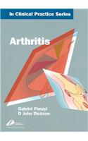 Arthritis