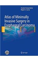 Atlas of Minimally Invasive Surgery in Esophageal Carcinoma