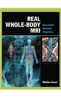 Real Whole-Body Mri: Requirements, Indications, Perspectives