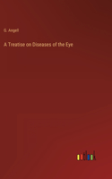 Treatise on Diseases of the Eye