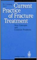 Current Practice of Fracture Treatment