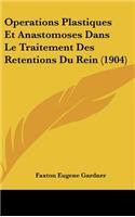 Operations Plastiques Et Anastomoses Dans Le Traitement Des Retentions Du Rein (1904)