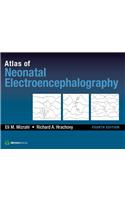 Atlas of Neonatal Electroencephalography