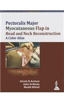 Pectoralis Major Myocutaneous Flap in Head and Neck Reconstruction: A Color Atlas