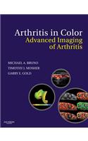 Arthritis in Color E-Book