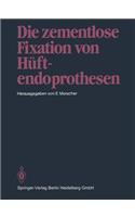 Die zementlose Fixation von Hüftendoprothesen