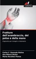 Fratture dell'avambraccio, del polso e della mano