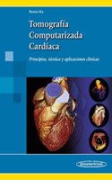 Tomografia computarizada cardiaca. Principios, tecnica y aplicaciones clinicas