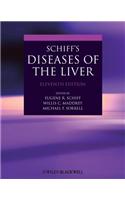 Schiff's Diseases of the Liver [With Web Access]