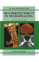 Multidetector CT in Neuroimaging
