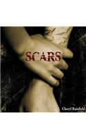 Scars